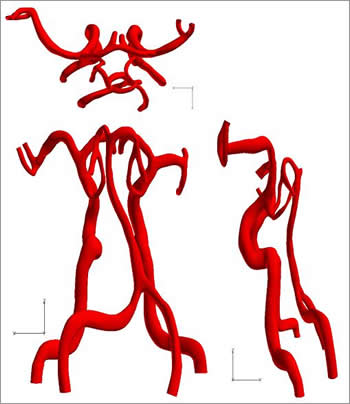 血管表面の例